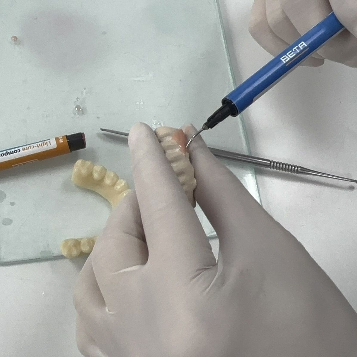 Dentalmaterialien Polymerporze – Uv Resin Bewertung und Preis